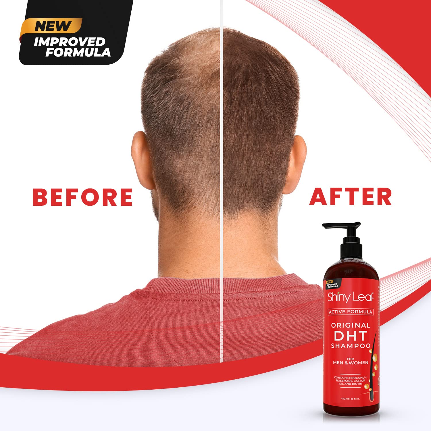 DHT Blocker Hair Loss Shampoo 16 oz, Active Formula For Hair Growth With Biotin